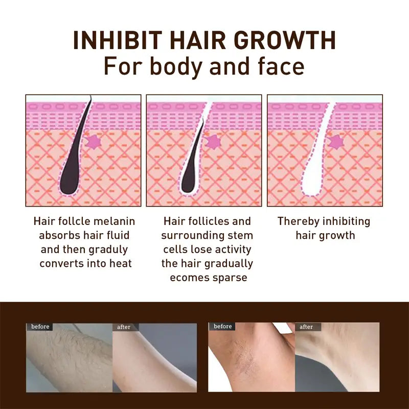 SmoothMist Gentle Body Hair Remover – 30ml