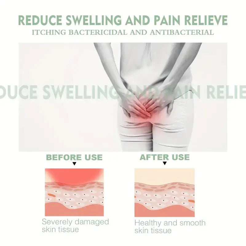 GentleRelief Cream for Sensitive Hemorrhoid Care