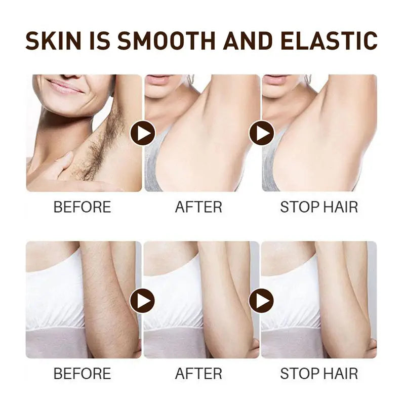 SmoothMist Gentle Body Hair Remover – 30ml
